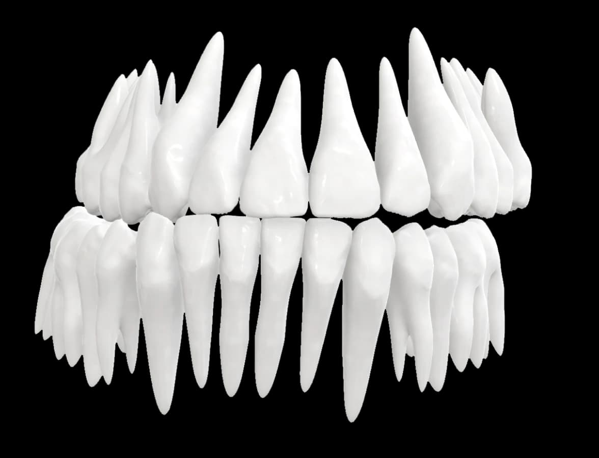 CROSSBITE
