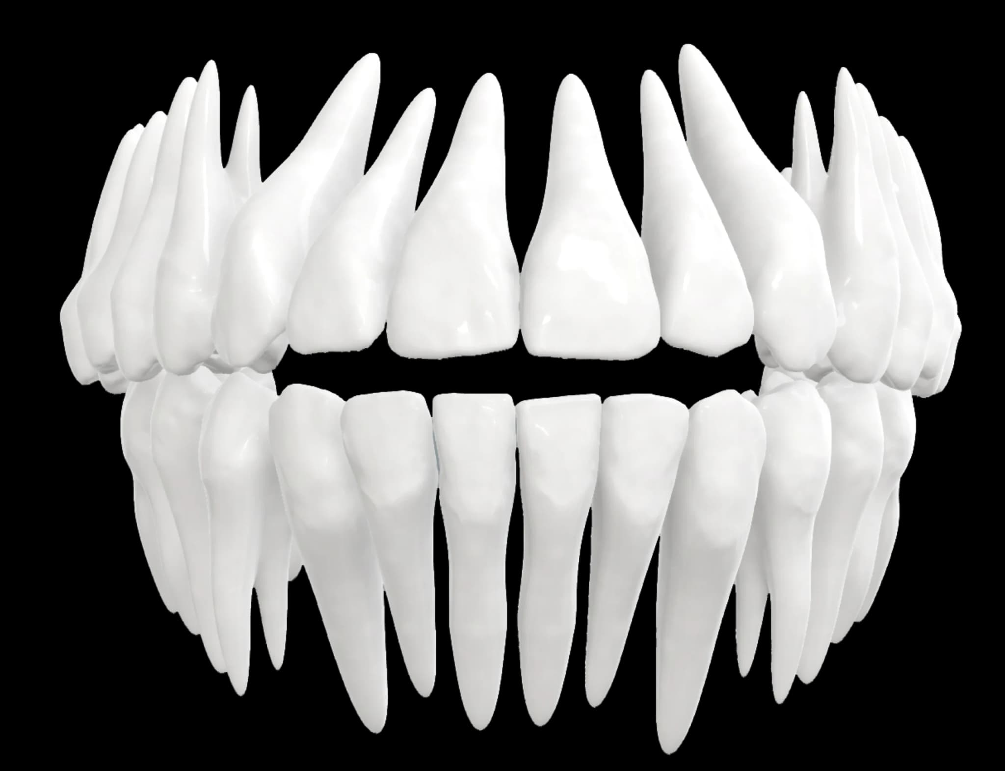 Open Bite